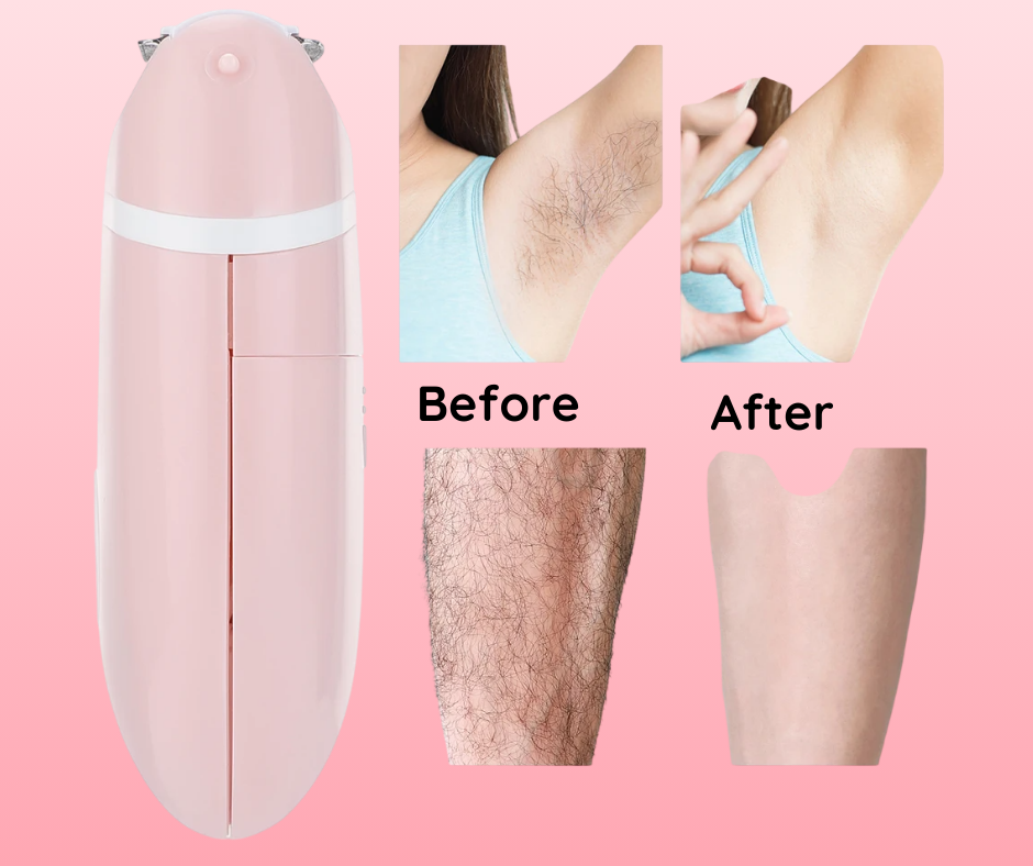 Mini Hair Removal Machine - OXENNE -  -  Best Selling  - Compact and efficient, Oxenne's Mini Hair Removal Machine delivers smooth, hair-free skin with precision and ease. - Mini Hair Removal Machine